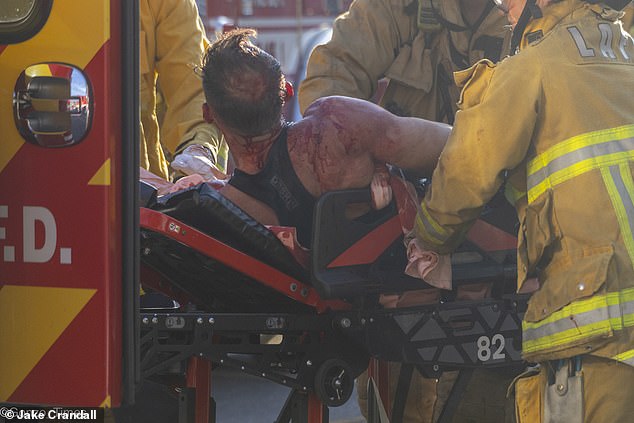 Bruno appears covered in blood immediately after the car accident, which occurred at a dangerous intersection just blocks from his home in Hollywood.