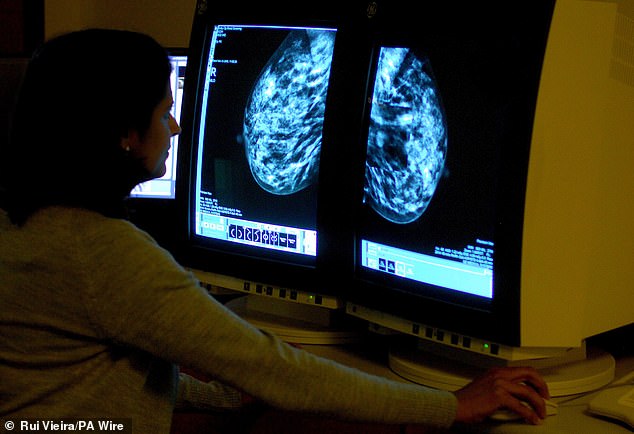 A consultant analyzing a mammogram to detect breast cancer. Triple negative breast cancer may be caused by a fault in the BRCA genes that increases the chances of developing certain types of cancer.