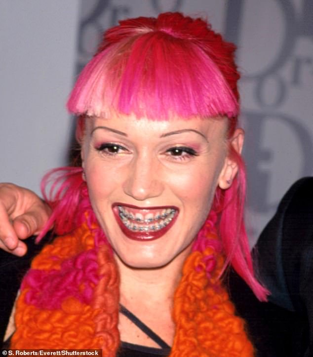 The star has undergone a notable transformation over the years, going from braces and pink hair to a blonde bombshell; Gwen seen in 1999