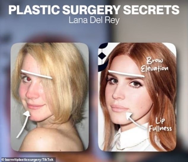 Dr. Barrett showed a previous photo in which Lana appeared to have a dorsal hump on her nose, compared to a recent photo in which he saw none.