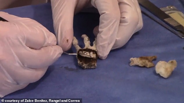 Correa told DailyMail.com that this hand of this supposed non-human mummy had been rehydrated by doctors Zalce and Rangel to better remove the 'metal implant' (above)