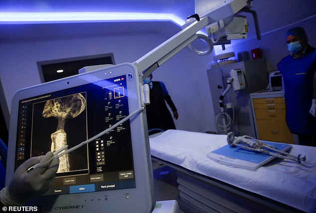 Radiology technician Guillermo Ramírez examines an x-ray of one of the Maussan 'Nazca mummy' specimens (above) at the Noor Clinic, in Huixquilucan, Mexico, on September 18, 2023.