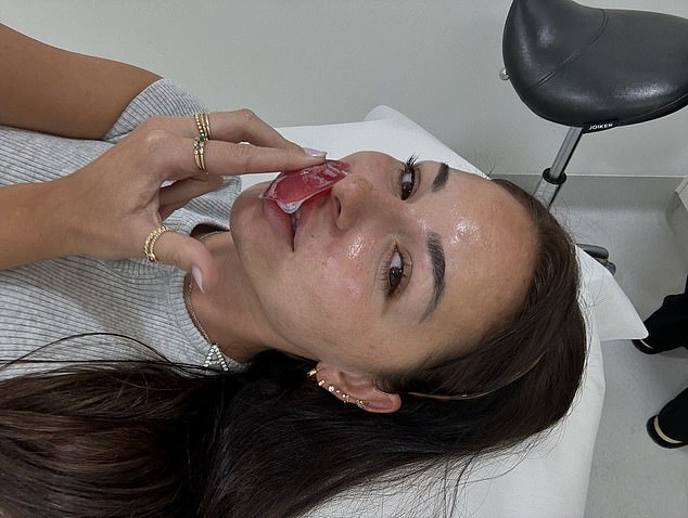 Another photo showed Anna reclining in a medical chair and holding an ice pack to her mouth.