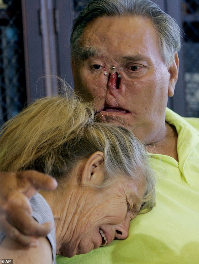 LaDonna, left, and St James Davis, lost body parts in a chimpanzee attack frenzy in 2005. Here they speak to reporters in 2008, after their chimpanzee 'boy' Moe disappeared and were never seen again.