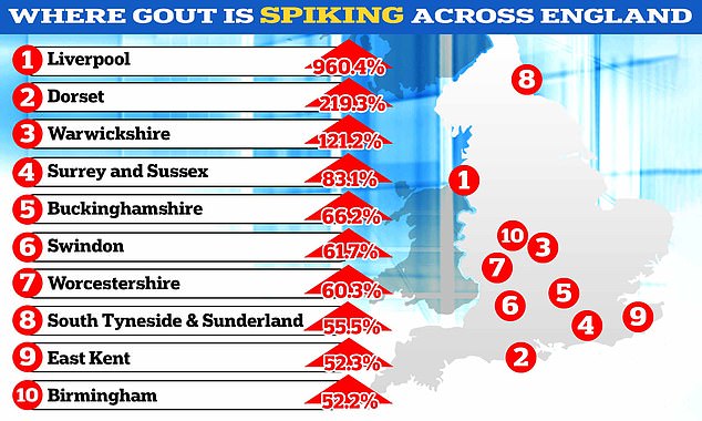 Data obtained through freedom of information laws found that Liverpool University Hospitals NHS Foundation Trust recorded 5,864 cases of gout in 2023.