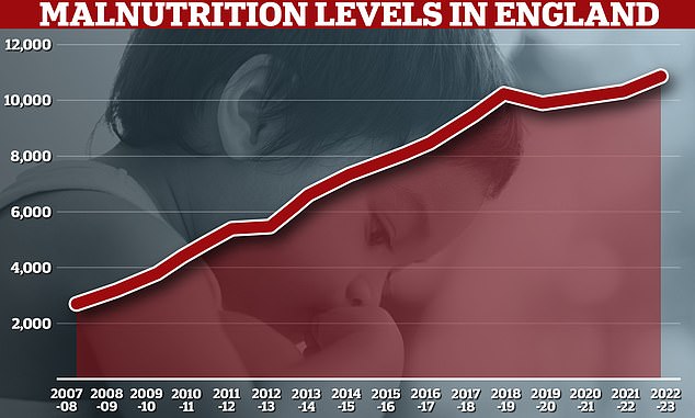 A Freedom of Information request from the Times Health Commission shows that 10,896 NHS patients in England were hospitalized with malnutrition in the year to April 2023. There were only around 2,700 hospitalizations for malnutrition in 2007/8, rising to 5,500 in 2012/13.