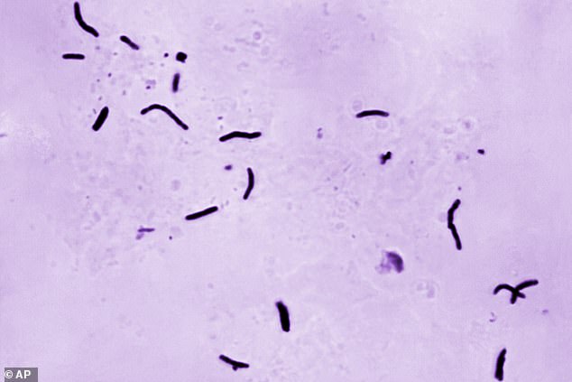 Tuberculosis is transmitted through the coughs and sneezes of infected people and most often emerges in the lungs, although it can reach other parts of the body. Microscopic view in the photo of Mycobacterium tuberculosis bacilli, the organism responsible for causing the disease.