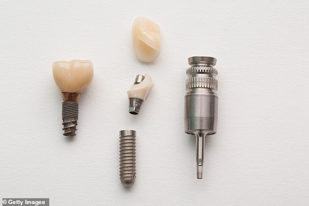 Implanted teeth can become infected but many people think they are foolproof. This, dentists say, is a fallacy.