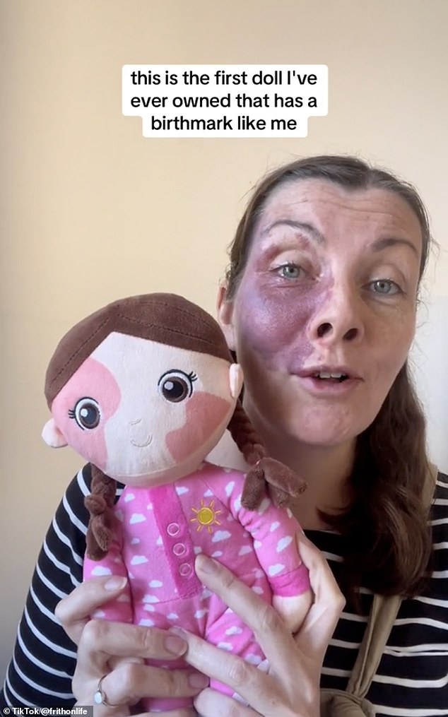 A mother-of-four from the Scottish Highlands, who goes by the name @frithonlife (pictured), said the Aldi toy is the first doll she has owned with a birthmark like hers.