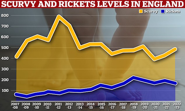 Statistics also revealed that 171 people were treated for scurvy and 482 for rickets, of which 405 were children.