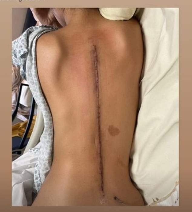 Jackie recently shared a snap on Instagram revealing her massive scar on her back.