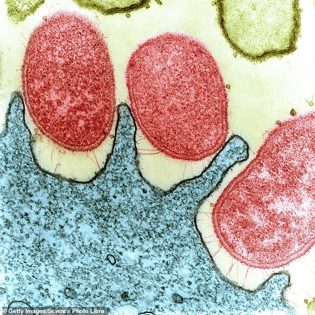 Color microscopic image of a human stomach (blue) infected with the bacteria Helicobacter pylori (red)