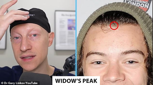 Dr. Linkov said in 2012 that Harry appeared to have a widow's peak.