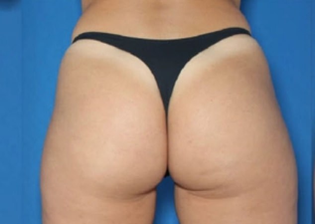 The experts tracked the eye movements of volunteers who were shown a series of female butts from different angles. In the photo: one of the rears used in the study.