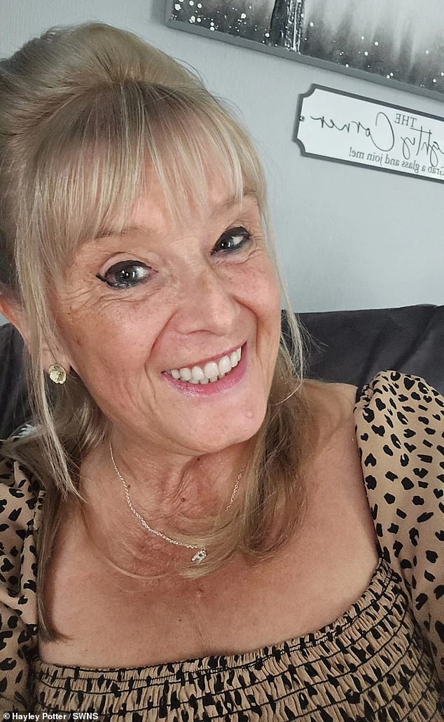 Hayley was fitted with a permanent denture to wear for six months, at which time her dental implants will be fully healed and she will be able to have her dental bridges fitted. 