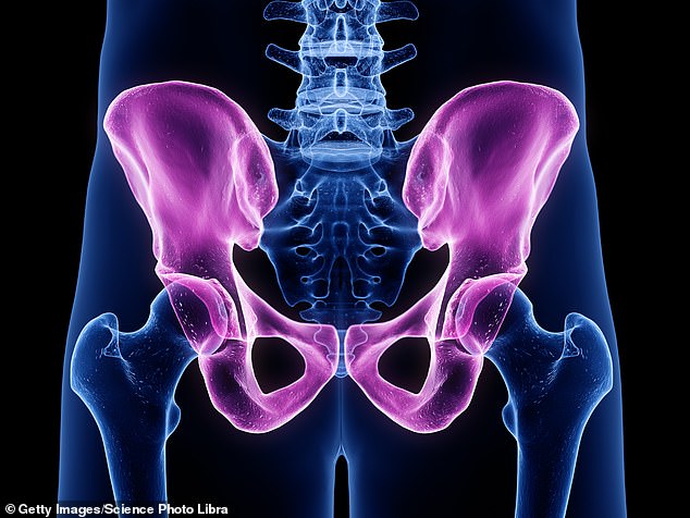 Around 100,000 people (mostly aged between 60 and 80) have hip replacement surgery each year on the NHS.