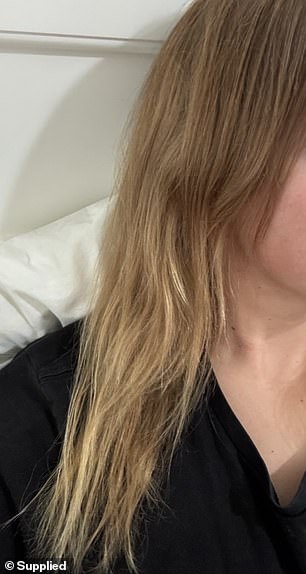 One shopper shared her results after using the overnight scalp serum for two months.