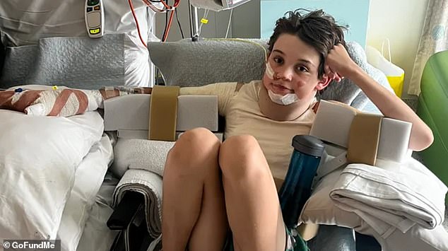 Levi has undergone eight surgeries to treat his burns and his parents hope their son's story will help parents recognize the dangers of synthetic clothing.