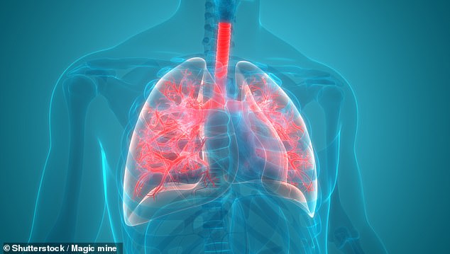 This detection technology could represent a breakthrough in the non-invasive detection of lung cancer