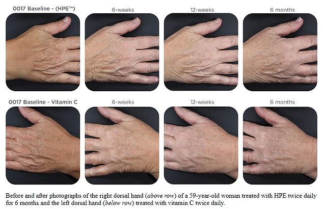 The images above show the hands of a 59-year-old volunteer; As above, he applied the high-priced serum to his right hand (top row) and the inexpensive serum to his left (bottom row). The low-cost product was best at reducing common signs of aging, including age spots and wrinkles.