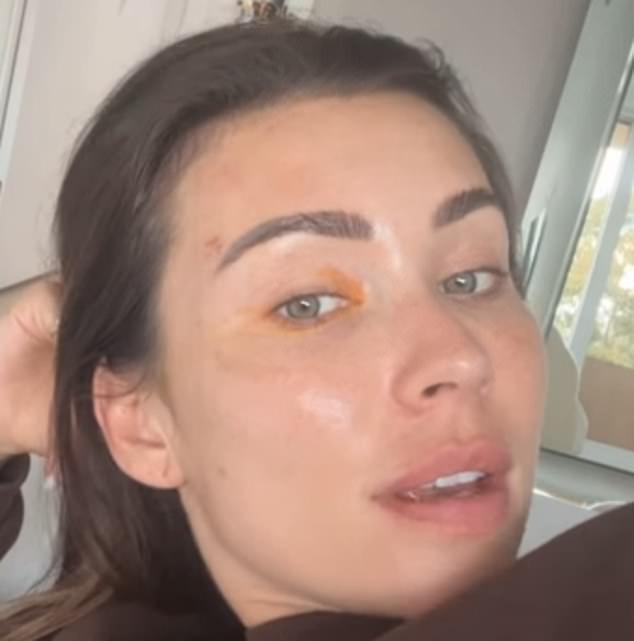 The influencer, 36, who is married to businessman Nick Russian, 45, shared a lengthy post on Instagram detailing her health issues and showing off her nasty eye rash (pictured).