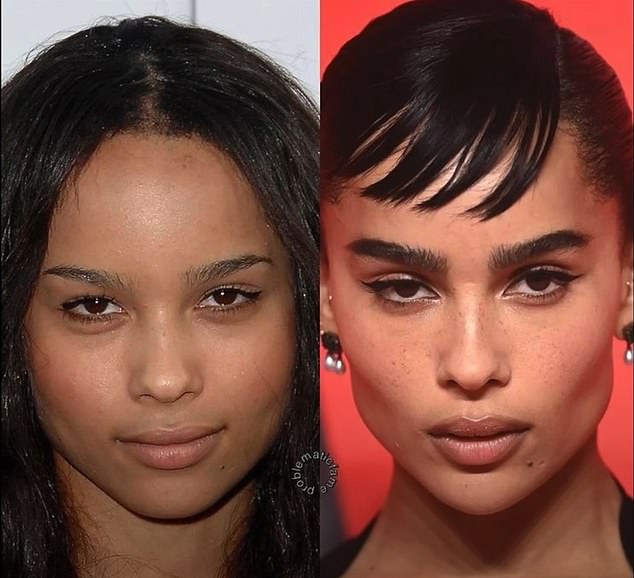 Zoe Kravitz is shown above in the early 2010s and again in 2017. Surgeons also suggest that she underwent buccal fat removal surgery.