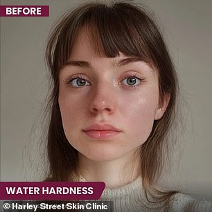 The image above is an AI-generated image that demonstrates how hard water, or water that contains a lot of dissolved minerals, could damage facial skin.