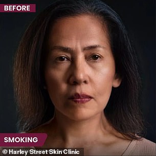 The image above is an AI generated image that demonstrates how smoking can affect a person's physical appearance.