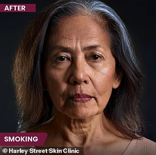 The image above is an AI generated image that demonstrates how smoking can affect a person's physical appearance.