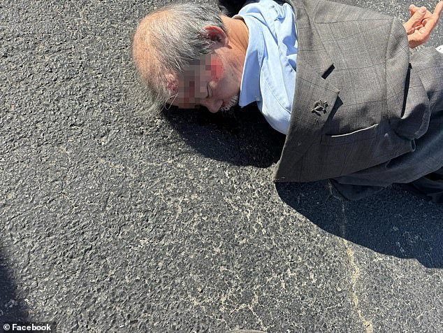 Lich is seen on the ground after the incident with cuts along the side of his face as he appeared unconscious.