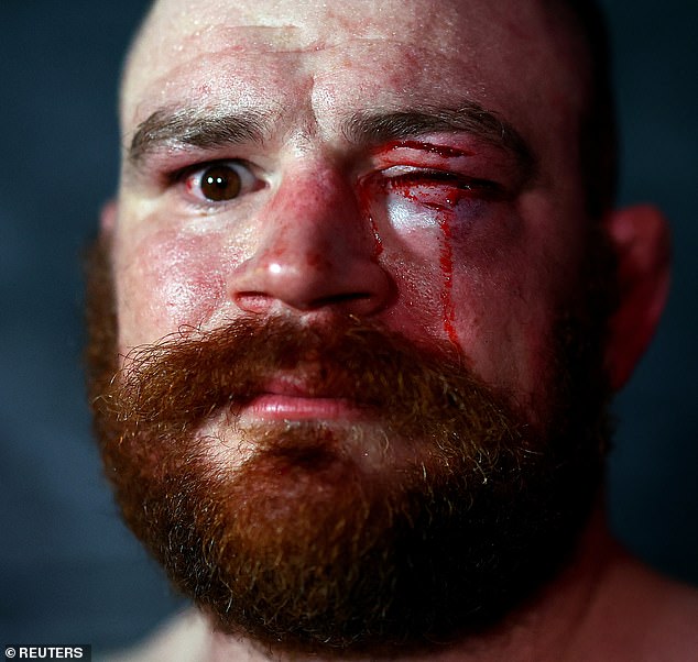 Bradley Scott was left with a swollen eye dripping with blood after his fight with BYB cruiserweight champion Marko Martinjak.