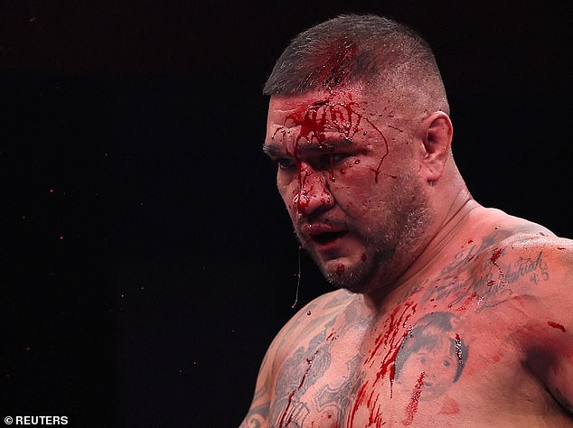 Naked boxer Ike Villanueva was dripping with blood during his fight at the Trigon