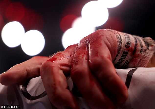 Kamil Sokolowsi's bloody hands cling to the ring ropes during the match.