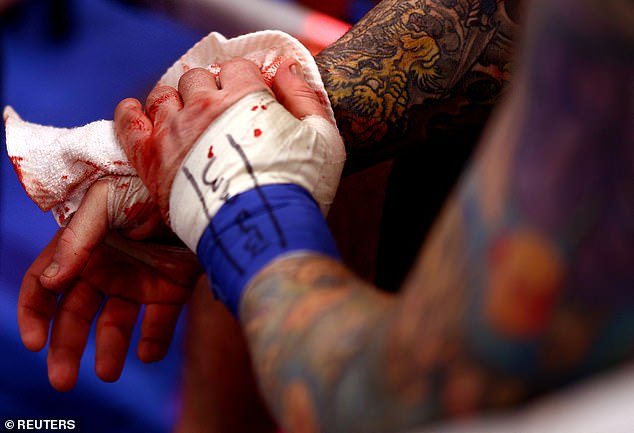 Bradley Scott wipes the blood off his hands after losing Friday's game at Wolverhampton.