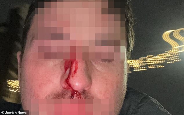 A British Jew known only as Aaron was left with blood streaming down his face after he intervened to help an Israeli football fan being attacked by an anti-Jewish gang in Amsterdam on Thursday night.