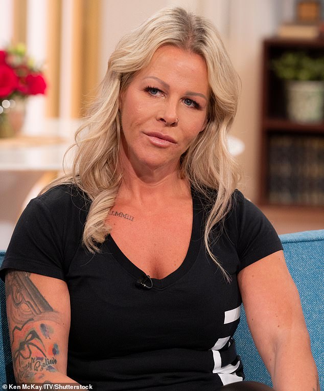 Michelle Heath (pictured) appeared on This Morning in April to talk about her horror plastic surgery which left her scarred for life.