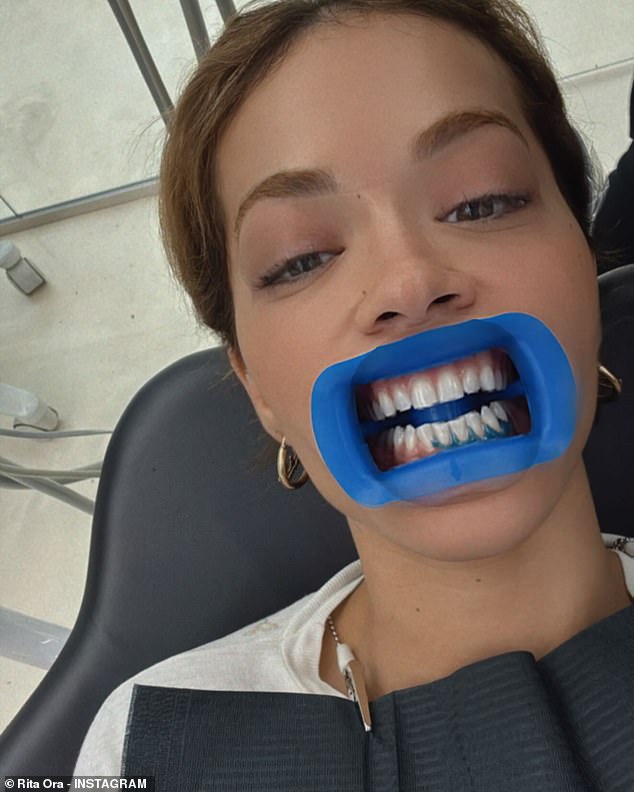 In stark contrast to the sizzling selfie, Rita then shared a photo of herself at the dentist with a mouth opener.