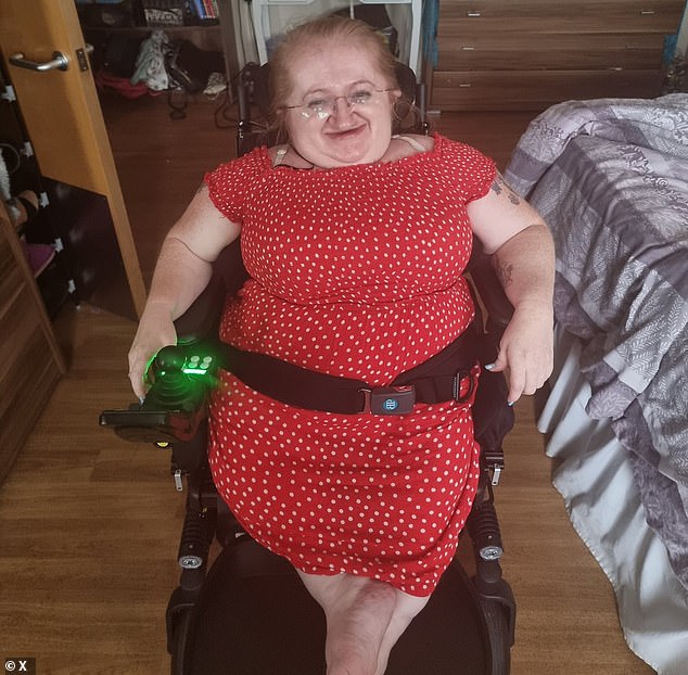 1731686184 962 Disabled woman 26 reveals intrusive questions people ask including