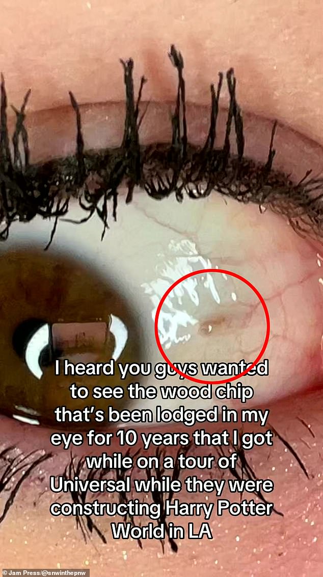 Woman Confesses A Splinter Has Been Stuck In Her Eye For 10 Years After ...