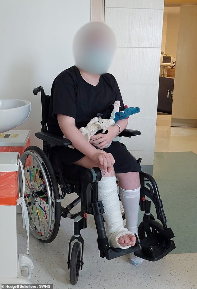 One of his alleged victims (pictured), who had a misalignment in his legs, had his leg amputated after Dr Jabbar allegedly botched his operation.