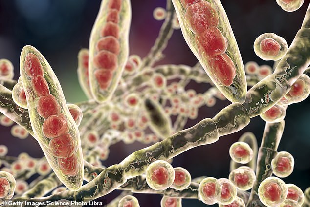 Pictured, illustration of Trichophyton mentagrophytes, the cause of ringworm of the scalp