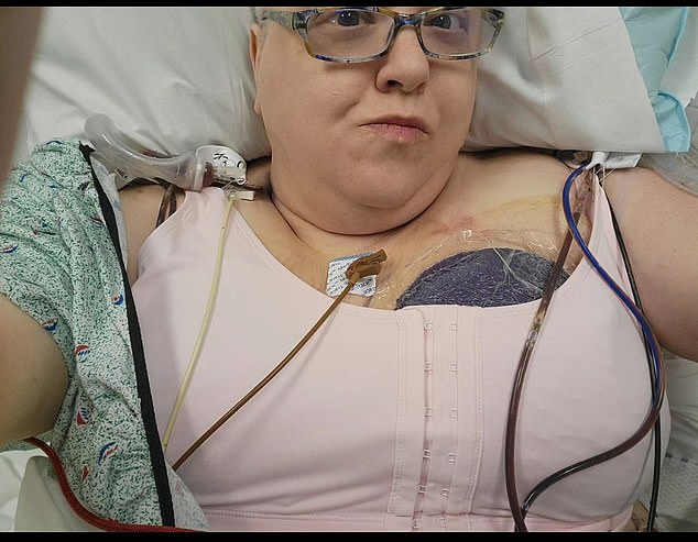 Ms Levinson is pictured after her mastectomy this year. Patients experiencing cancer have shared that their family members avoided them because seeing each other reminded them of death, leaving family members unsure of how to cope.