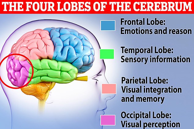 Allison's tumor was located in her occipital lobe, the visual processing center of the brain, with a red circle above.