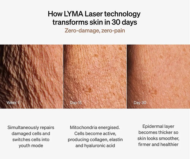 A results-oriented tool like the LYMA laser could be the most helpful addition to a routine focused on reducing the visible signs of aging.