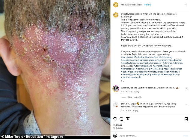 Barber Mike Taylor, who last week raised the alarm about the worrying rise in ringworm cases, has also shared images of clients affected by the disease.