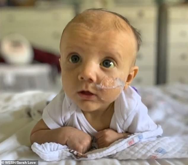 Lincoln underwent two surgeries, which left him in the hospital for more than a month, and then the boy was diagnosed with a rare genetic condition known as Alagille syndrome.