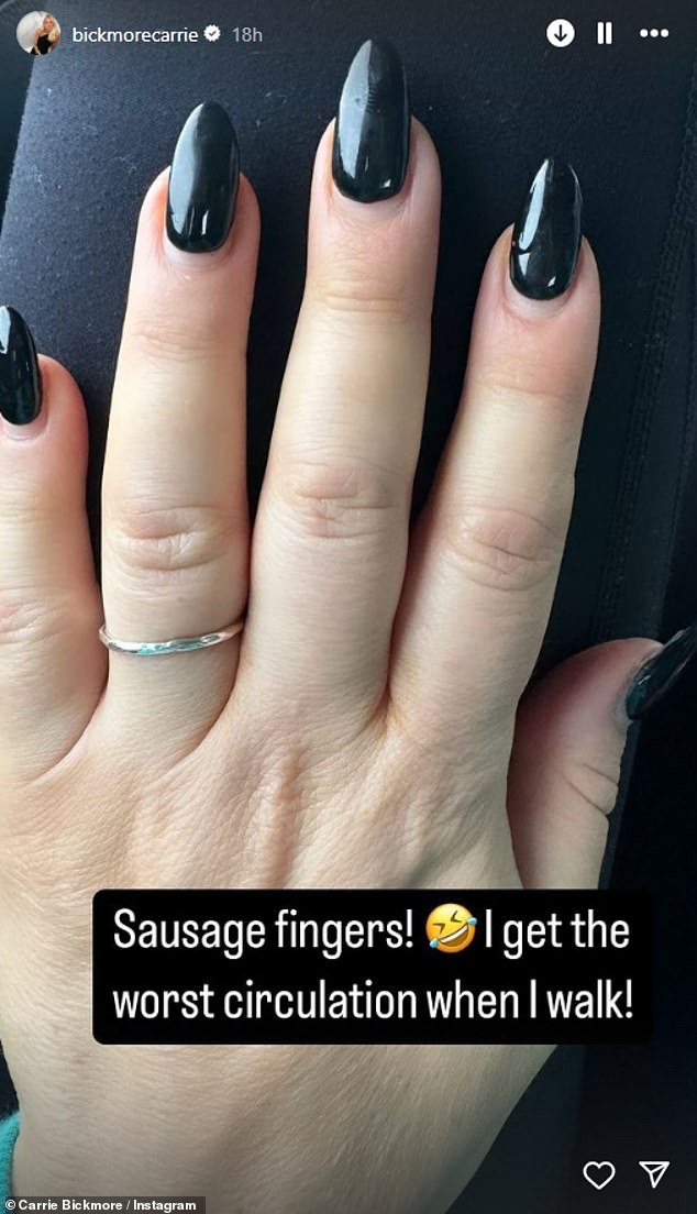 'Sausage fingers!' Bickmore wrote alongside a picture of her very swollen hands. 