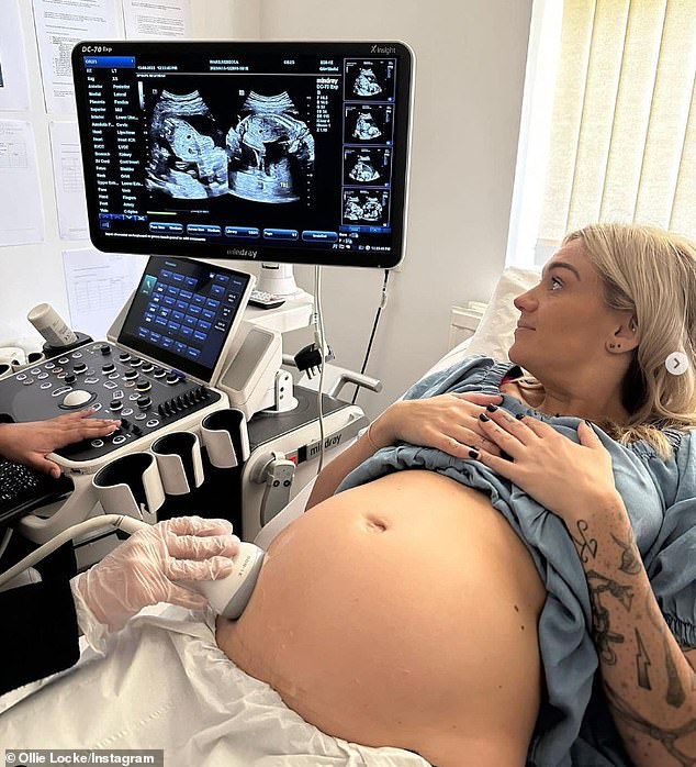 Before their surrogate, Bex Ward, welcomed their son and daughter in July 2023, the couple had two miscarriages, one at six weeks pregnant in 2021, with their first surrogate.