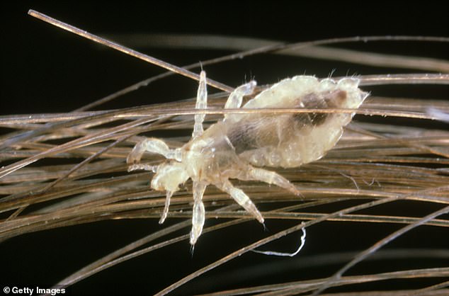 The TikTok account whatifshow recently revealed that up to 20,000 small insects could live on your head within a month, many of which would resist treatment.