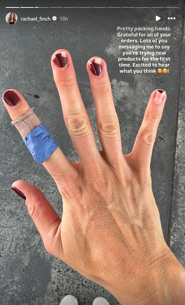 Rachael posted a picture of her hand with Band-Aids wrapped around her finger and chipped nail polish.